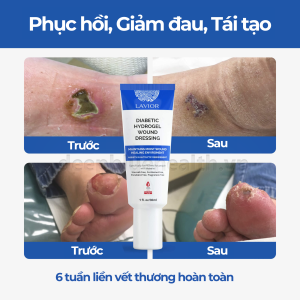 Băng vết thương dạng gel LAVIOR Diabetic Hydrogel Wound Dressing 30ml