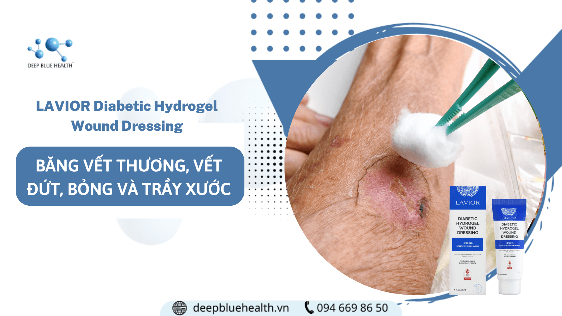 Chọn LAVIOR Diabetic Hydrogel Wound Dressing – Băng vết thương, vết đứt, vết bỏng và trầy xước dạng gel LAVIOR Diabetic Hydrogel Wound Dressing – Băng vết thương, vết đứt, vết bỏng và trầy xước dạng gel