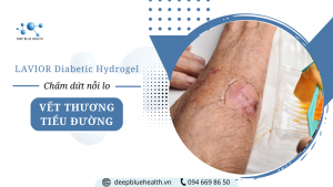 cham-dut-noi-lo-vet-thuong-tieu-duong-voi-lavior-diabetic-hydrogel