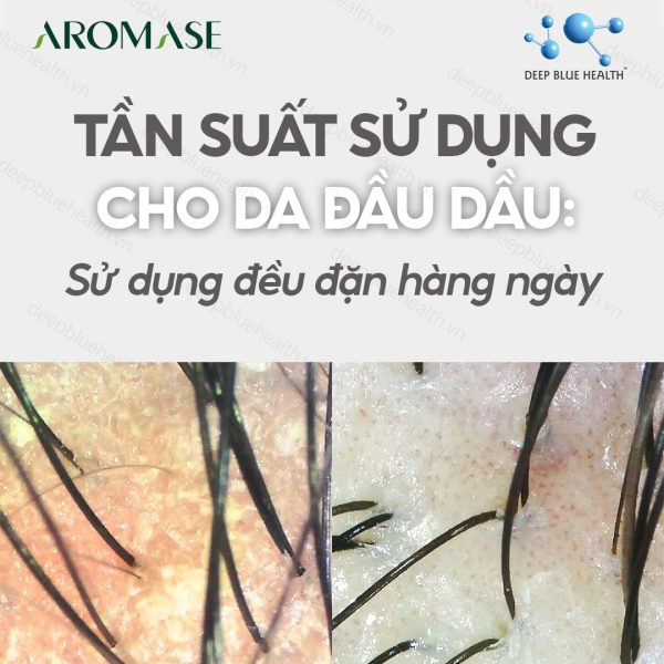 Dầu gội cân bằng da đầu nhờn Aromase Oily Scalp Balancing Shampoo 90ml  1