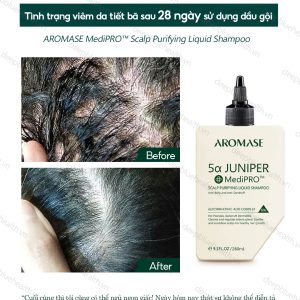 Dầu gội làm sạch chuyên sâu dạng lỏng Aromase 5α Juniper MediPRO Scalp Purifying Liquid Shampoo 80ml 3