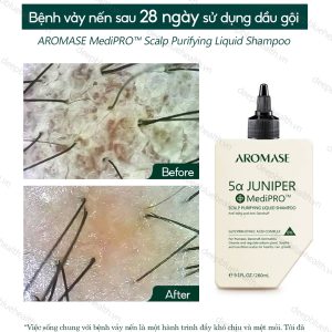 Dầu gội làm sạch chuyên sâu dạng lỏng Aromase 5α Juniper MediPRO Scalp Purifying Liquid Shampoo 80ml 4
