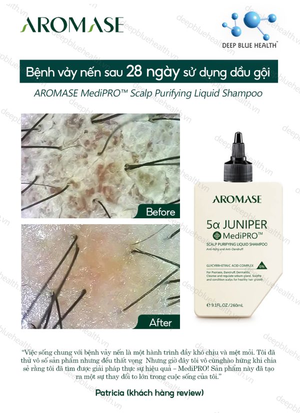Dầu gội làm sạch chuyên sâu dạng lỏng Aromase 5α Juniper MediPRO Scalp Purifying Liquid Shampoo 80ml 4