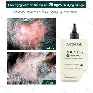 Dầu gội làm sạch chuyên sâu dạng lỏng Aromase 5α Juniper MediPRO Scalp Purifying Liquid Shampoo 80ml 5