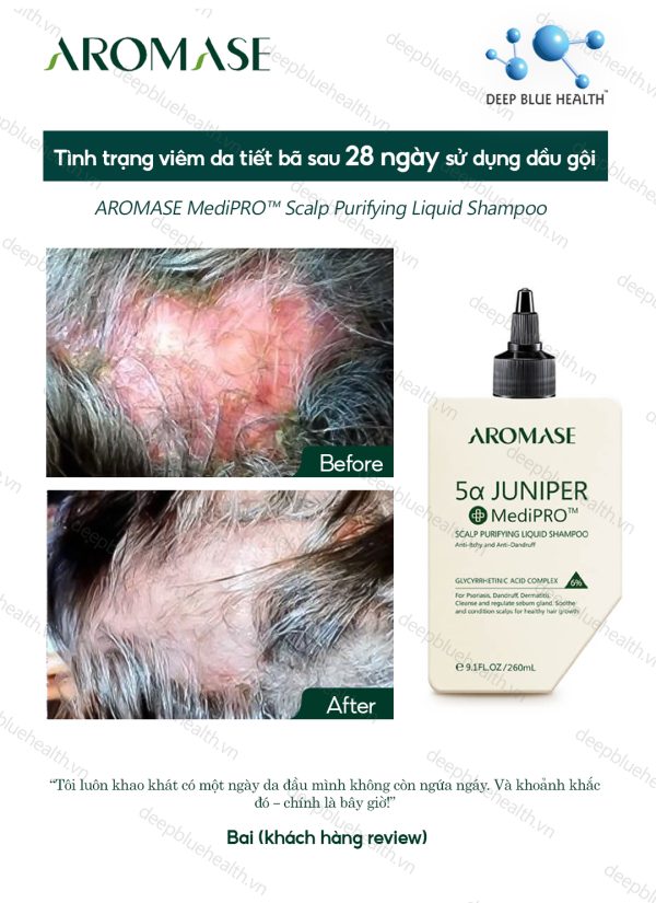Dầu gội làm sạch chuyên sâu dạng lỏng Aromase 5α Juniper MediPRO Scalp Purifying Liquid Shampoo 80ml 5
