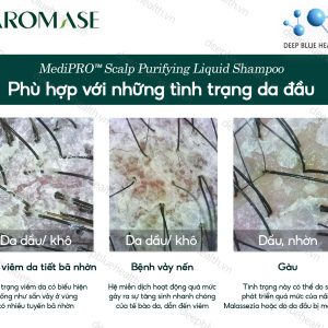 Dầu gội làm sạch chuyên sâu dạng lỏng Aromase 5α Juniper MediPRO Scalp Purifying Liquid Shampoo 80ml 6