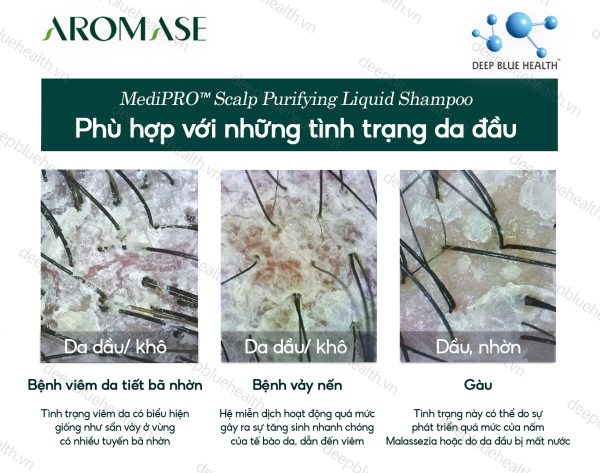 Dầu gội làm sạch chuyên sâu dạng lỏng Aromase 5α Juniper MediPRO Scalp Purifying Liquid Shampoo 80ml 6