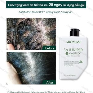 Dầu gội ngăn gàu, giảm viêm chuyên sâu cho da dầu Aromase 5α Juniper MediPRO Simply Fresh Shampoo 80ml 1
