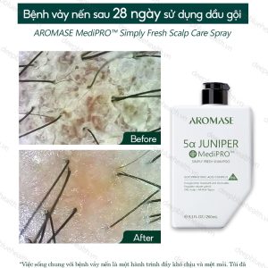 Dầu gội ngăn gàu, giảm viêm chuyên sâu cho da dầu Aromase 5α Juniper MediPRO Simply Fresh Shampoo 80ml 1