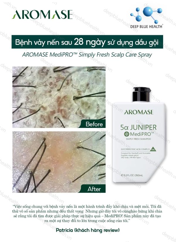 Dầu gội ngăn gàu, giảm viêm chuyên sâu cho da dầu Aromase 5α Juniper MediPRO Simply Fresh Shampoo 80ml 1