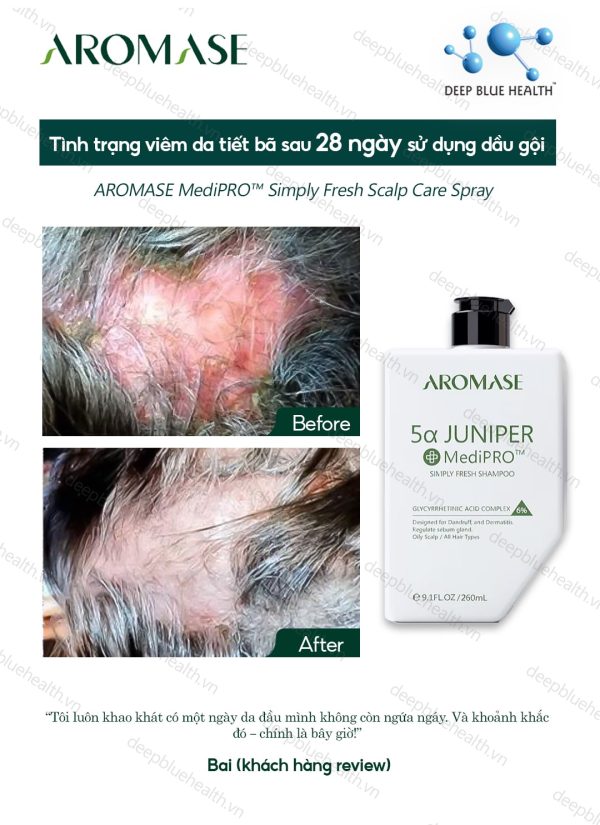 Dầu gội ngăn gàu, giảm viêm chuyên sâu cho da dầu Aromase 5α Juniper MediPRO Simply Fresh Shampoo 80ml 5