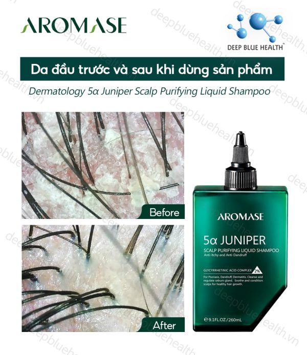 Dầu gội sạch sâu da đầu dạng lỏng Aromase 5α Juniper Scalp Purifying Liquid Shampoo 80ml 3