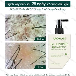 Xịt chăm sóc da đầu dầu chuyên sâu Aromase 5α Juniper MediPRO Simply Fresh Spray 110ml 3