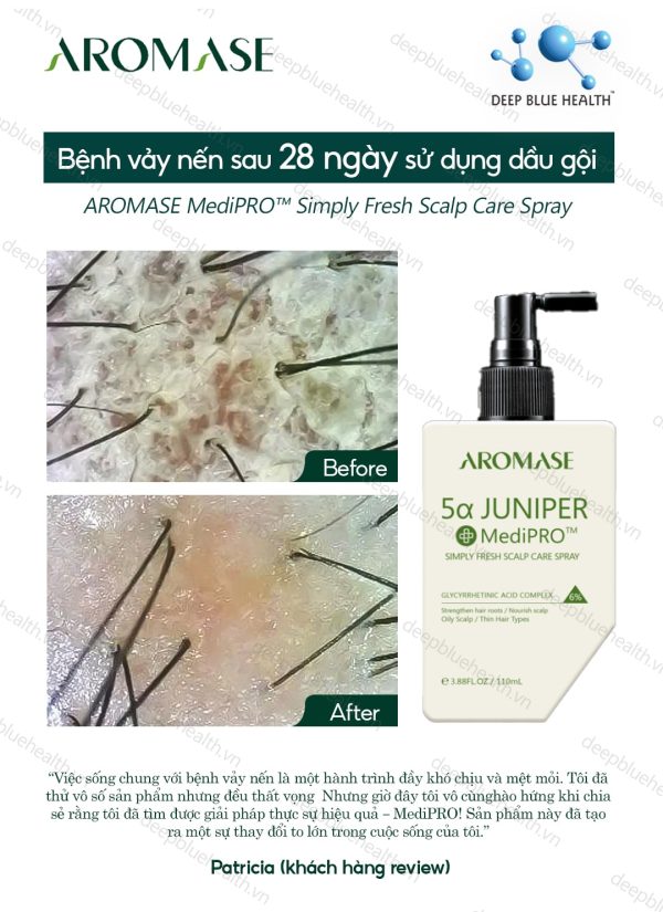 Xịt chăm sóc da đầu dầu chuyên sâu Aromase 5α Juniper MediPRO Simply Fresh Spray 110ml 3
