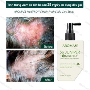 Xịt chăm sóc da đầu dầu chuyên sâu Aromase 5α Juniper MediPRO Simply Fresh Spray 110ml 5
