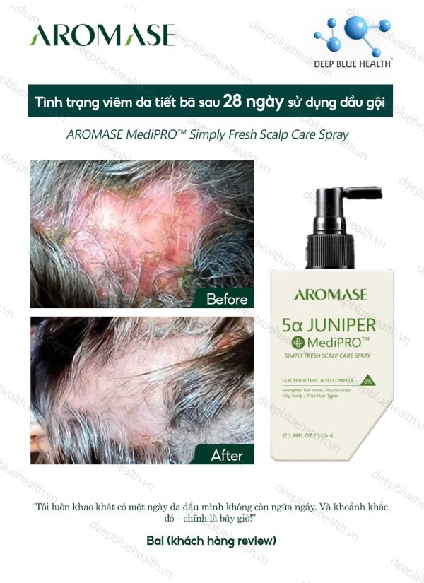 Xịt chăm sóc da đầu dầu chuyên sâu Aromase 5α Juniper MediPRO Simply Fresh Spray 110ml 5