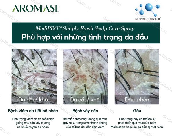 Xịt chăm sóc da đầu dầu chuyên sâu Aromase 5α Juniper MediPRO Simply Fresh Spray 110ml 6