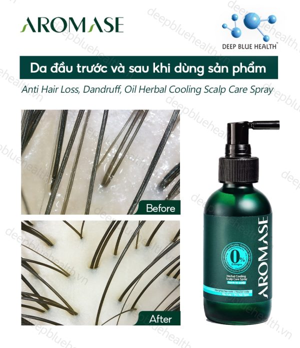 Xịt dưỡng thảo dược làm dịu da đầu dầu Aromase Herbal Cooling Scalp Care Spray 40ml 2