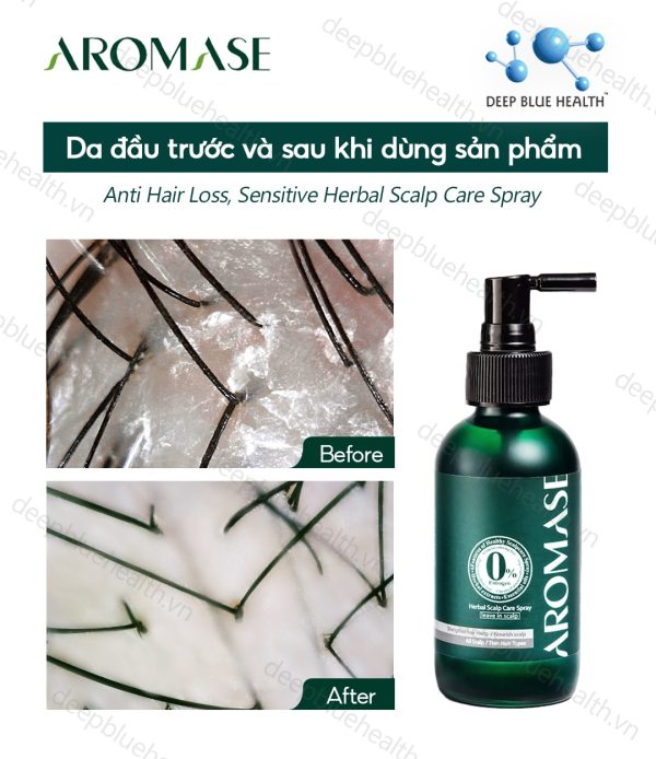 Xịt thảo dược cấp ẩm cho da đầu khô Aromase Herbal Scalp Care Spray 40ml 1